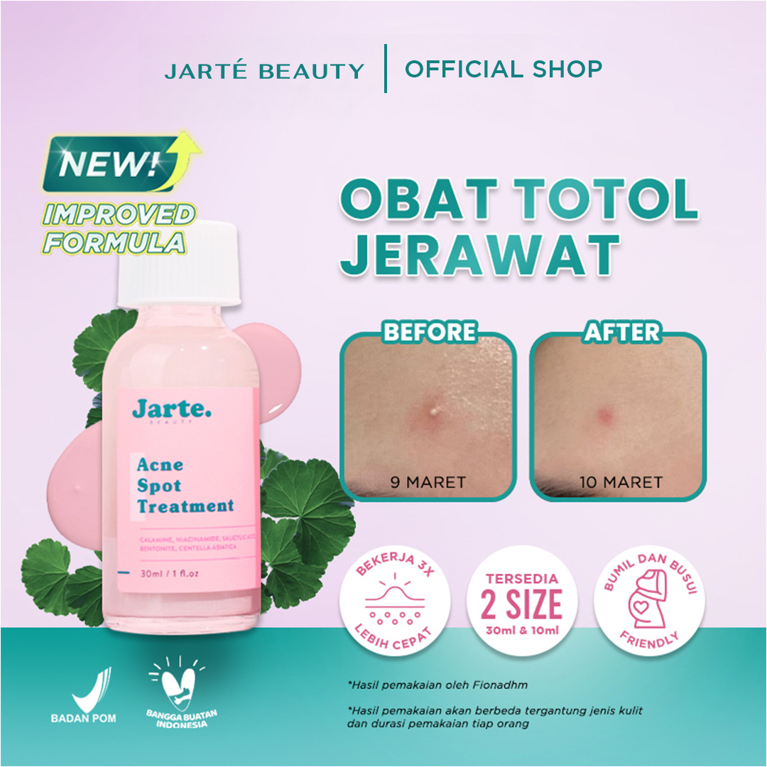 Jarte Beauty - Bye Bye Acne Spot Treatment - Image 4